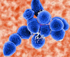 streptococcus_pneumoniae_2