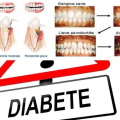 Omeopatia e parodontopatia nei pazienti diabetici